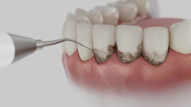 Trusted Tooth Extraction service in Browns Lake, WI - Dentist Open Now